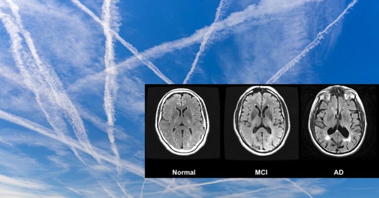 Nano-Aluminium in Chemtrails für Alzheimer-Epidemie verantwortlich